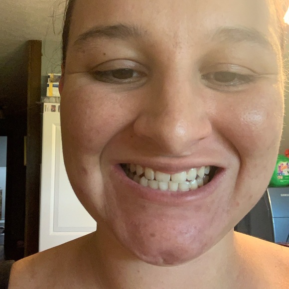 Whitening toothpaste! - Picture 10 of 11